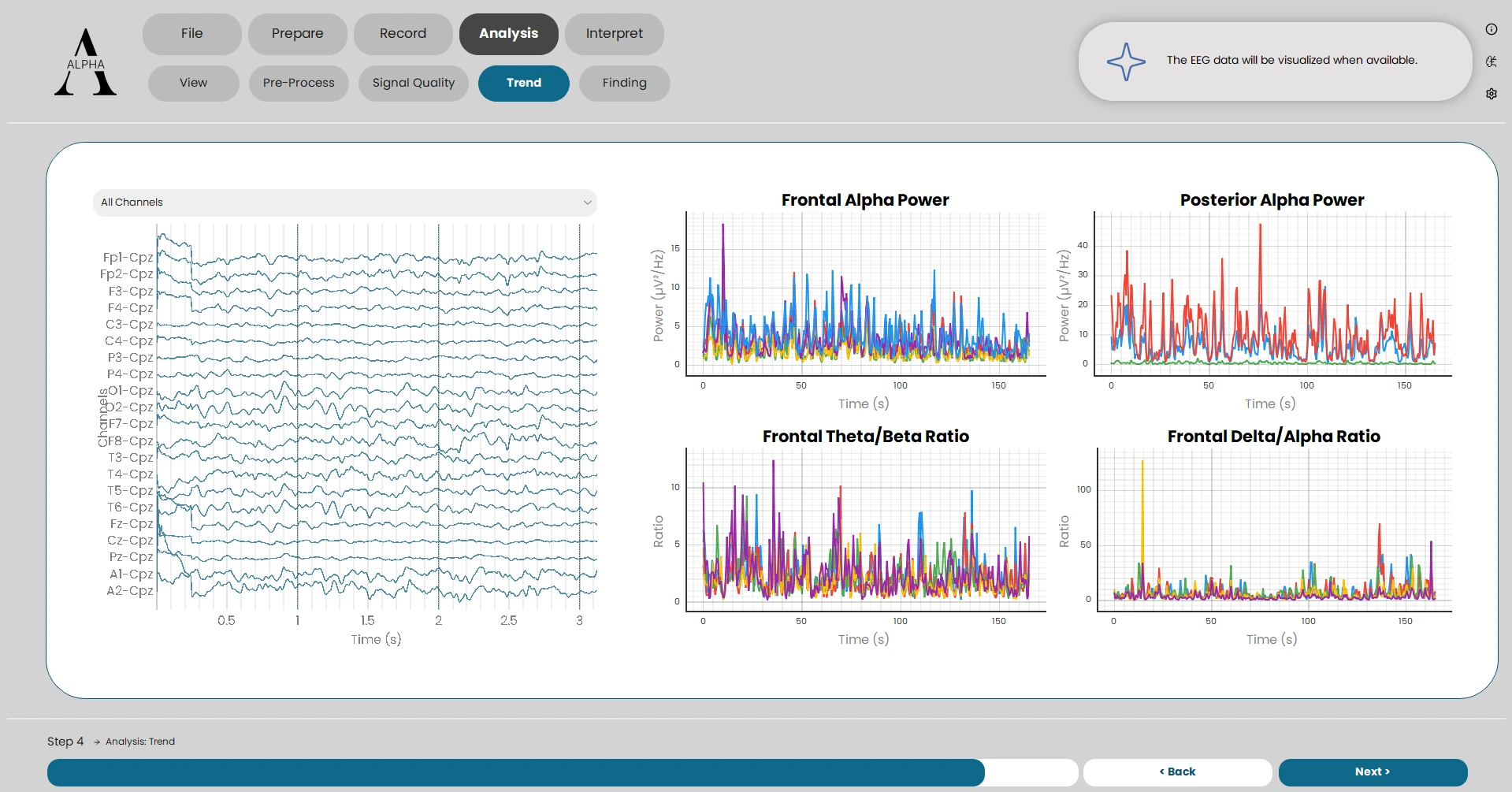 Signal Analysis Trends