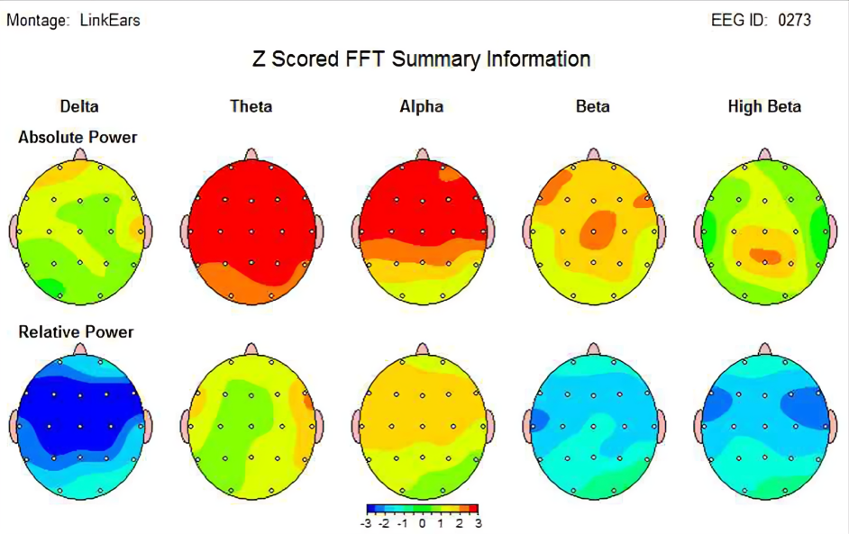 Case Study Brain Mapping