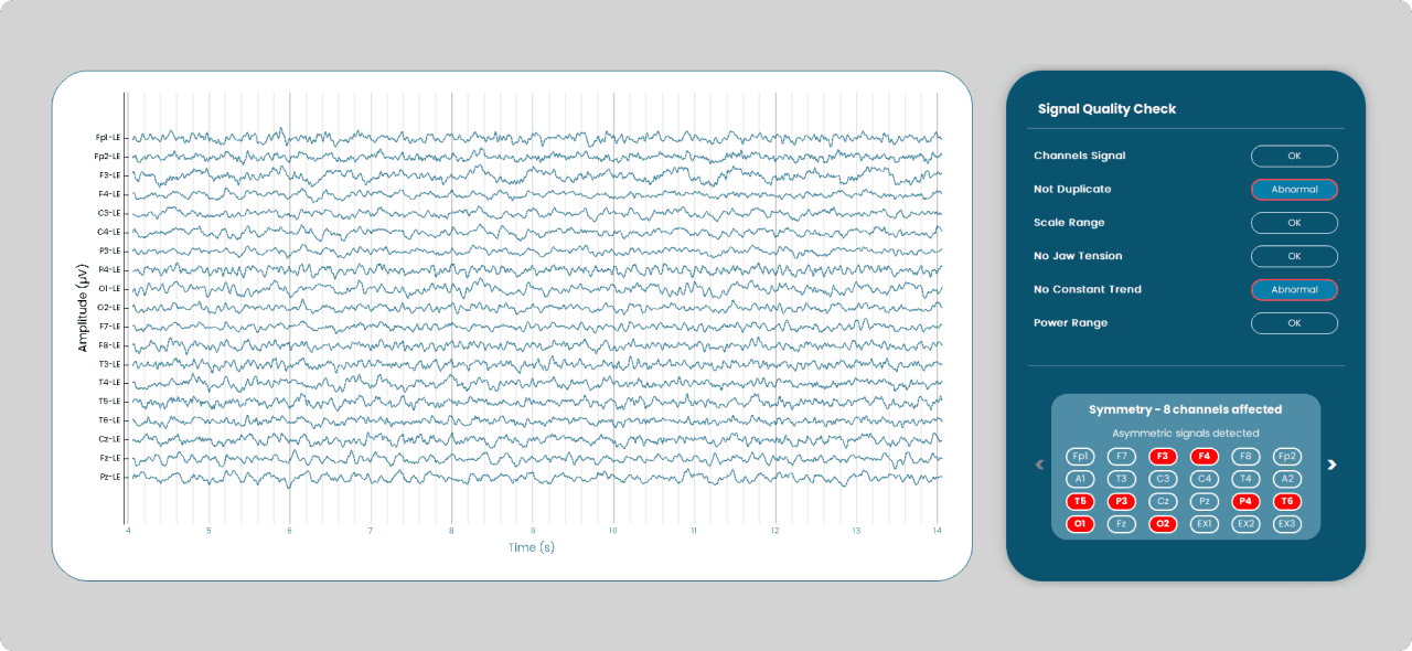 Signal Quality Control